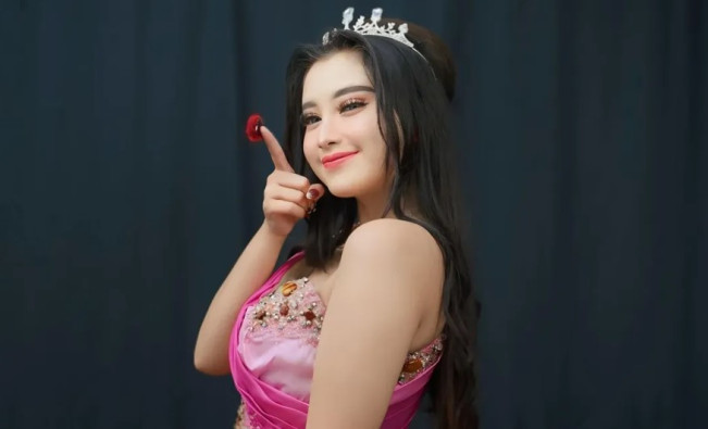 Penyanyi dangdut dan aktor FTV Cantika Davinca alami kecelakaan di Magetan, pada Jumat (3/10/2025). (Instagram)